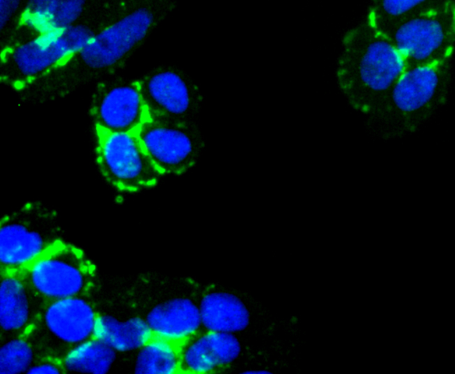 Laminnin 5 alpha 3 Rabbit mAb