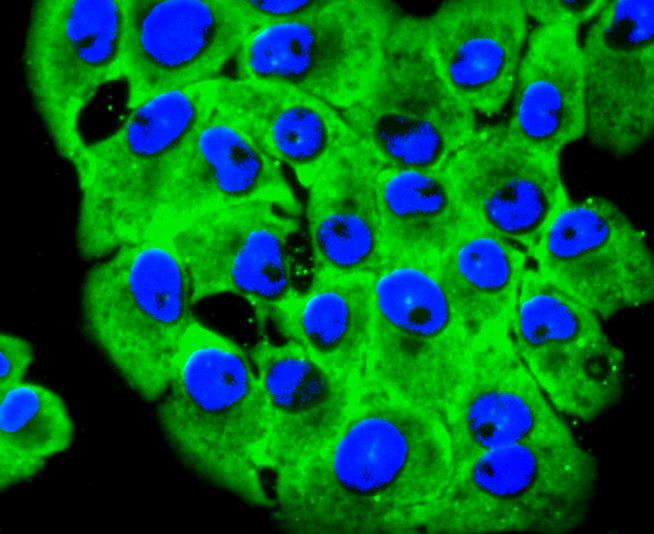 67kDa Laminin Receptor Rabbit mAb