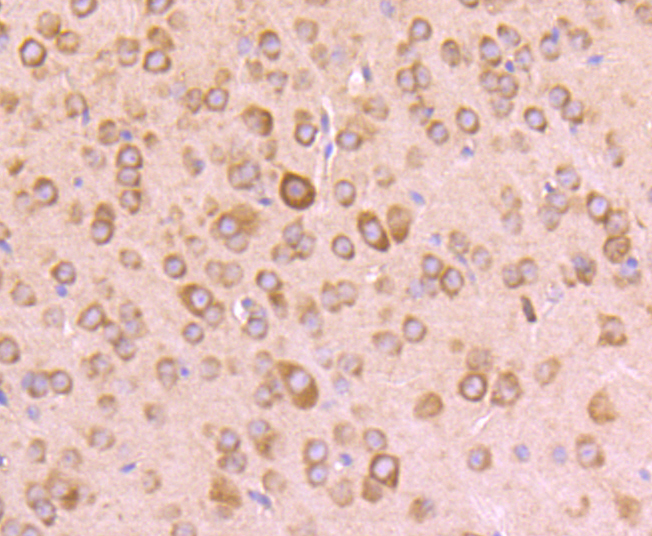 67kDa Laminin Receptor Rabbit mAb