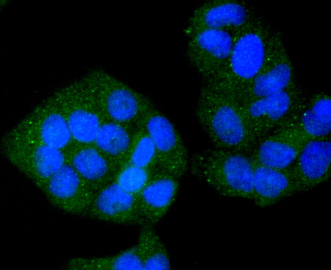 VAMP8 Rabbit mAb