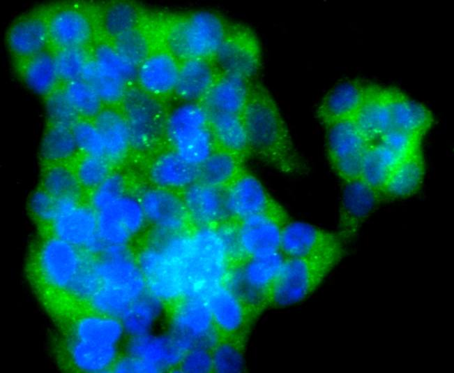 VAMP8 Rabbit mAb