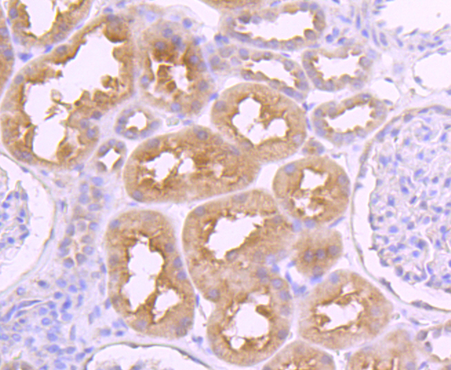 VAMP8 Rabbit mAb