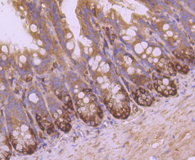 VAMP8 Rabbit mAb