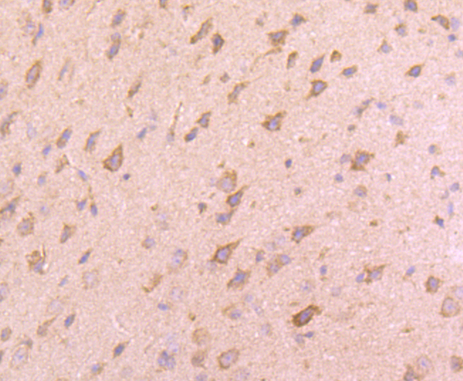 VAMP8 Rabbit mAb