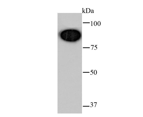 Glucocorticoid Receptor Rabbit mAb