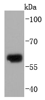 Collagen X Rabbit mAb