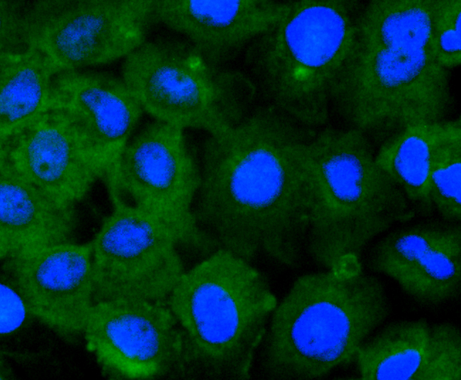 STAT2 Rabbit mAb