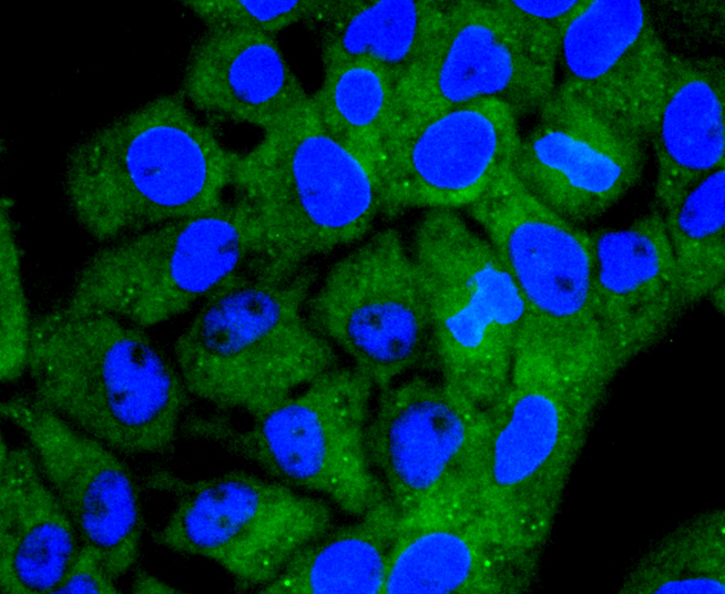Acetyl CoA synthetase Rabbit mAb