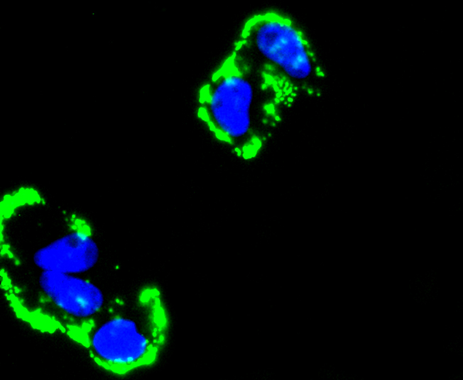 Fibronectin Rabbit mAb