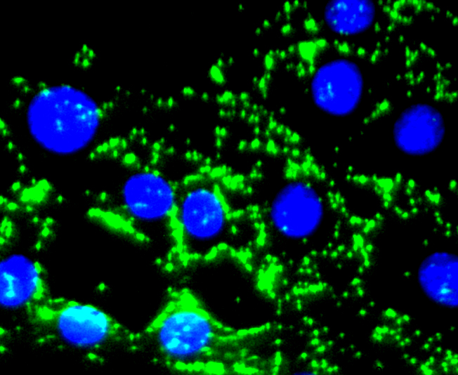 Fibronectin Rabbit mAb