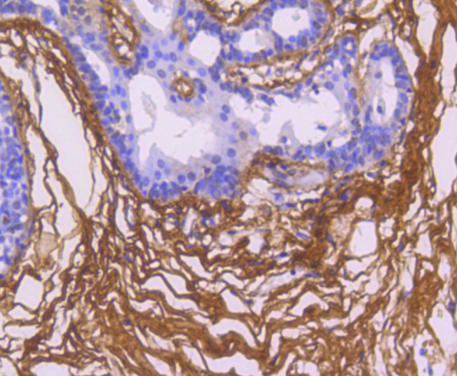Fibronectin Rabbit mAb