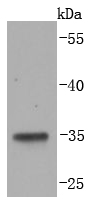 LYVE1 Rabbit mAb