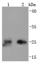 Thymidine Kinase 1 Rabbit mAb