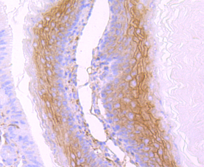gamma Catenin Rabbit mAb