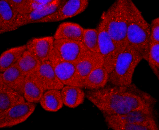 CD99 Rabbit mAb