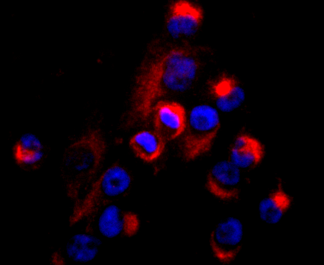 CD99 Rabbit mAb