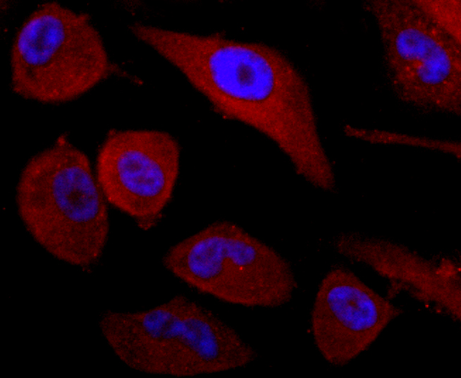 CD99 Rabbit mAb