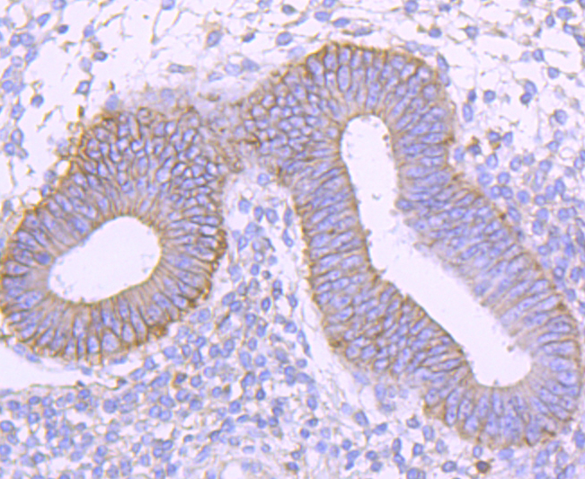 CD99 Rabbit mAb