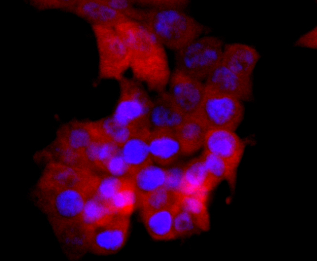 Superoxide Dismutase 1 Rabbit mAb