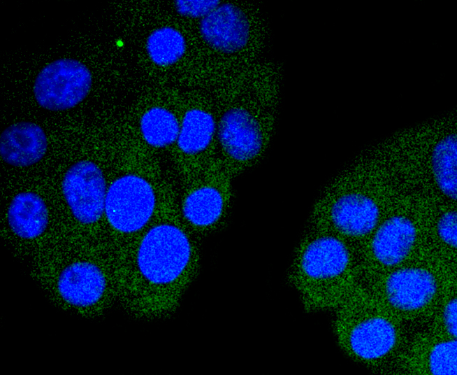 Cardiac Troponin I Rabbit mAb
