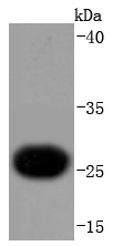 Cardiac Troponin I Rabbit mAb