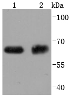 ABCG2 Rabbit mAb