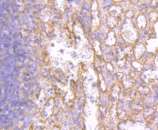 MHC class I Rabbit mAb