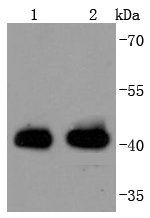 MHC class I Rabbit mAb