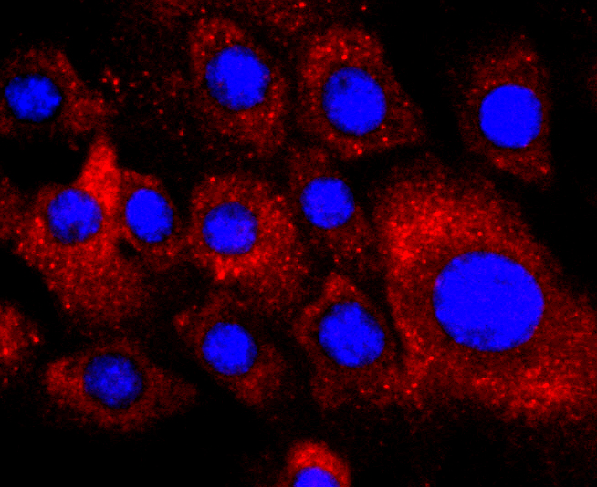 PDGFR alpha Rabbit mAb