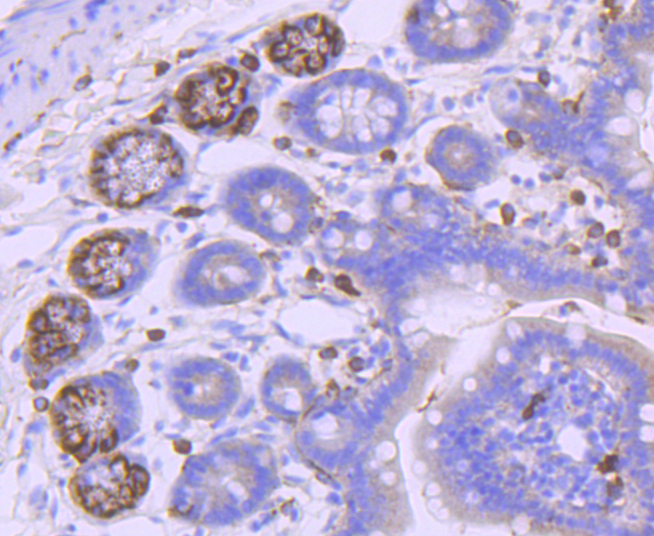 PDGFR alpha Rabbit mAb