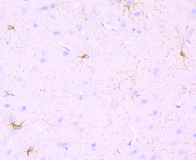 PDGFR alpha Rabbit mAb