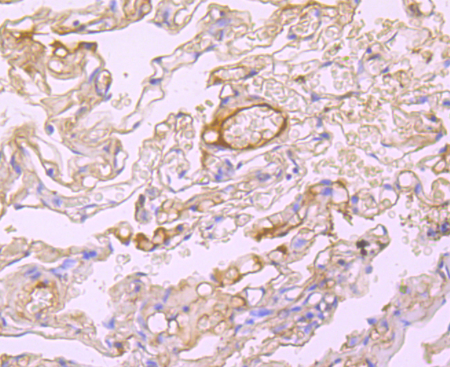 Albumin Rabbit mAb