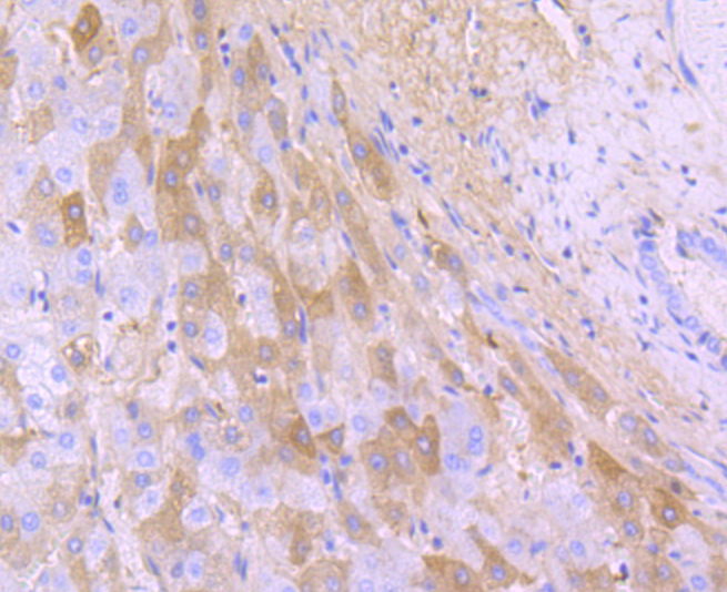 Albumin Rabbit mAb