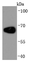 Albumin Rabbit mAb