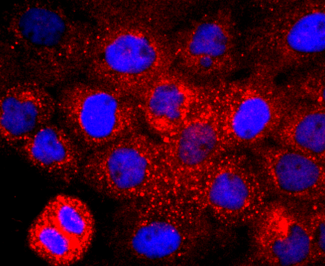 CD147 Rabbit mAb