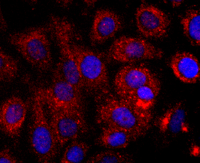 CD147 Rabbit mAb