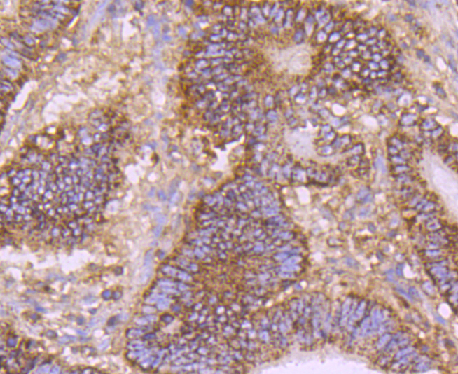 CD147 Rabbit mAb