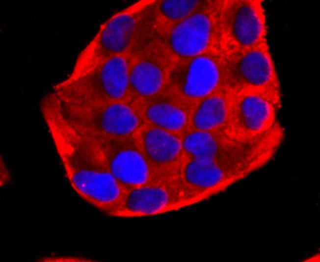 PDHA1 Rabbit mAb
