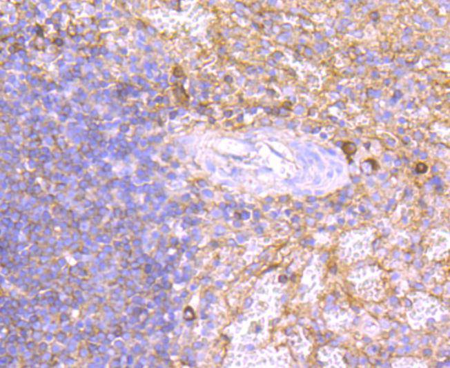 Human IgM Rabbit mAb