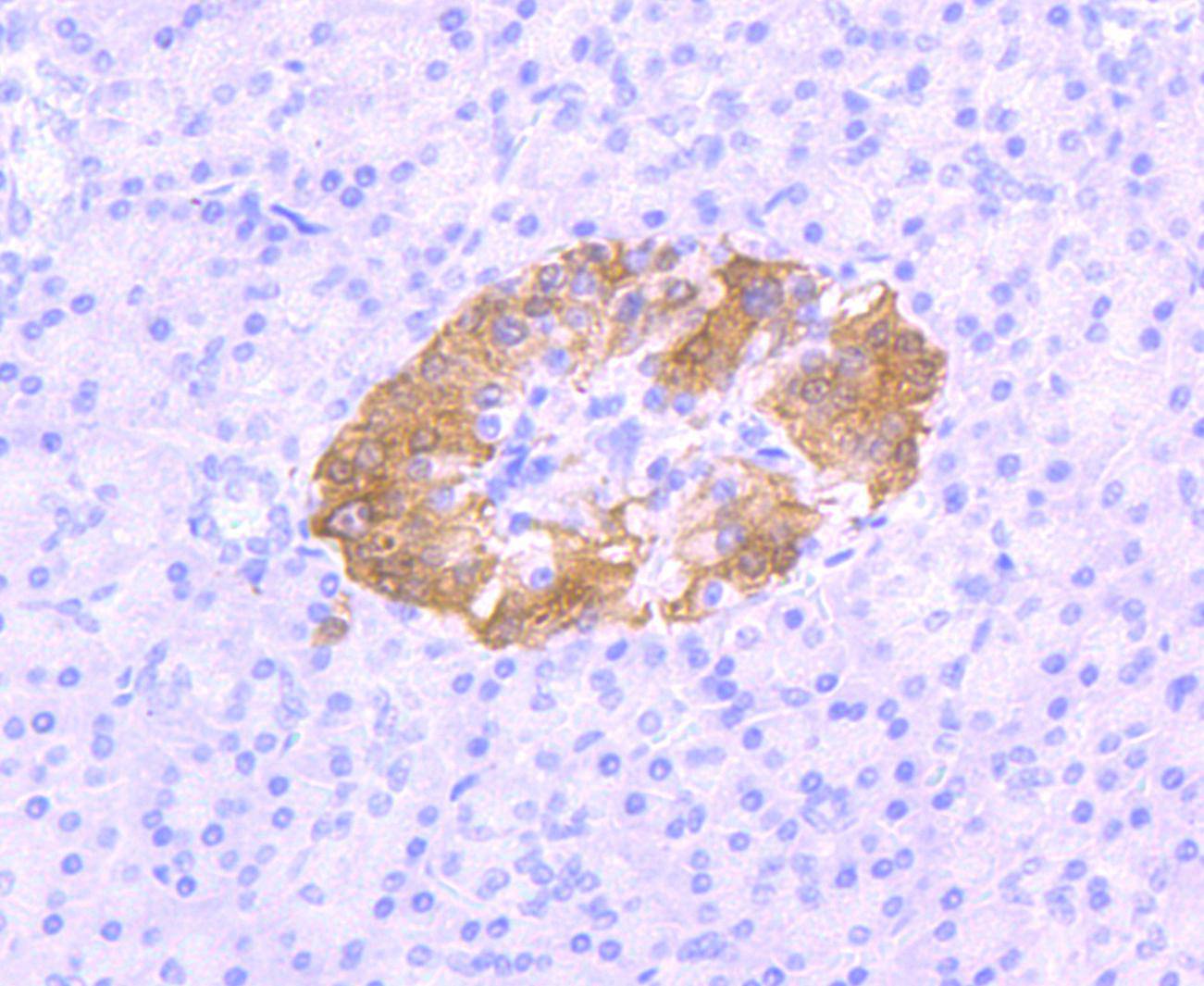 PGP9.5 Rabbit mAb