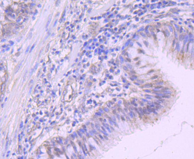 NEDD8 Rabbit mAb