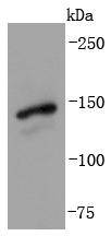 Gli1 Rabbit mAb