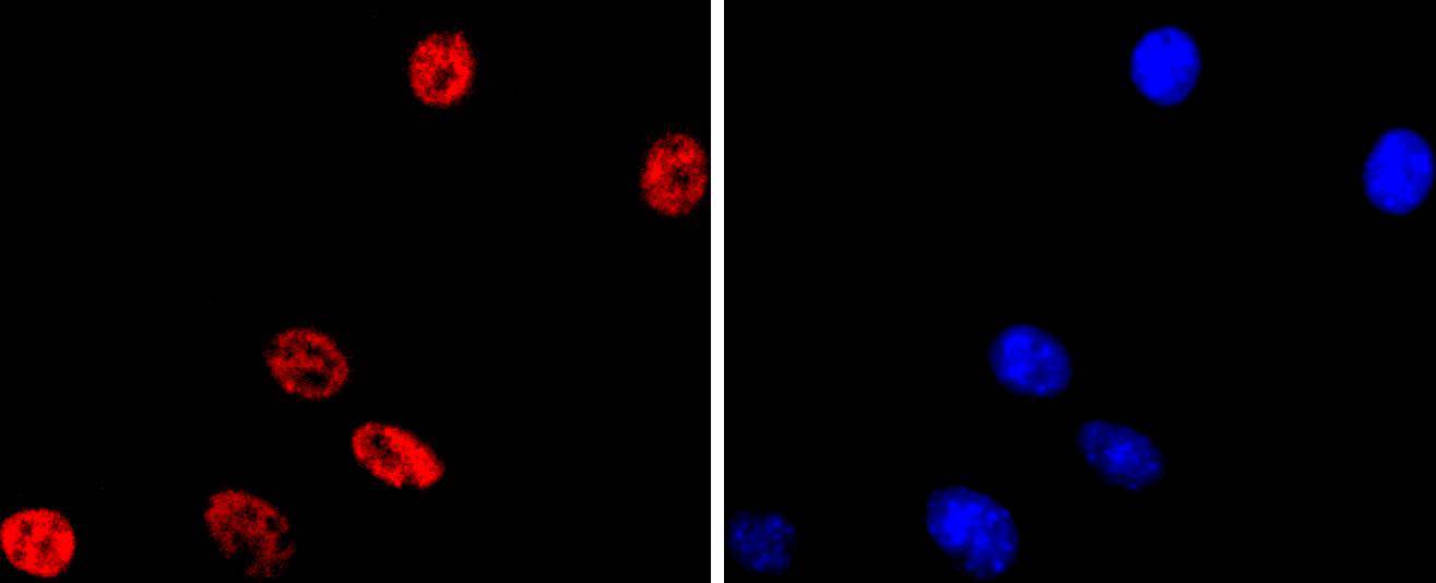 MiTF Rabbit mAb