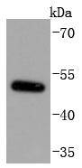 MiTF Rabbit mAb