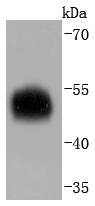 alpha 1 Antitrypsin Rabbit mAb