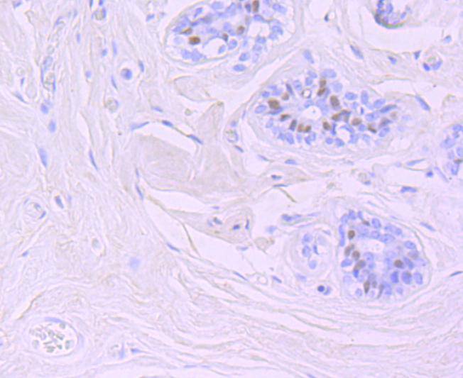 FOXA1 Rabbit mAb