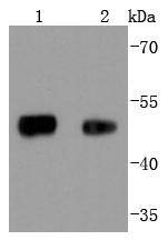 FOXA1 Rabbit mAb