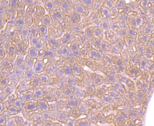 beta 2 Adrenergic Receptor Rabbit mAb