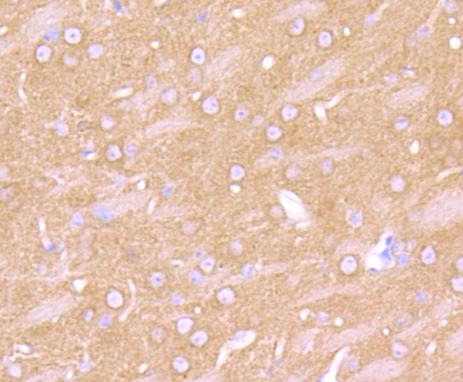 beta 2 Adrenergic Receptor Rabbit mAb