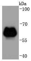 beta 2 Adrenergic Receptor Rabbit mAb